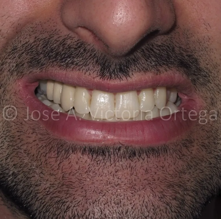 Gallery - Mandeep - 4 - After