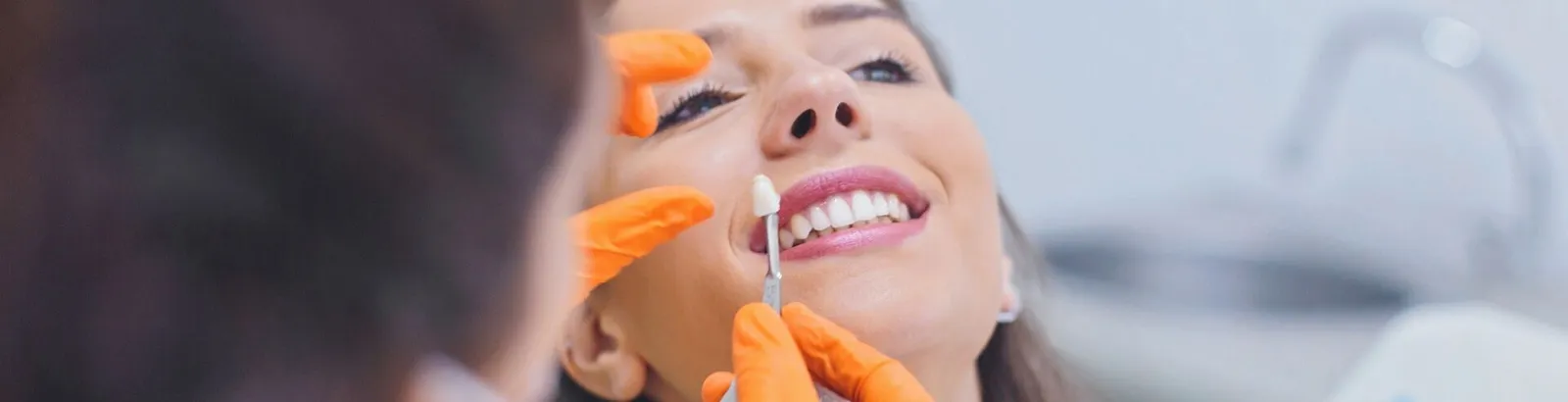Teeth Whitening