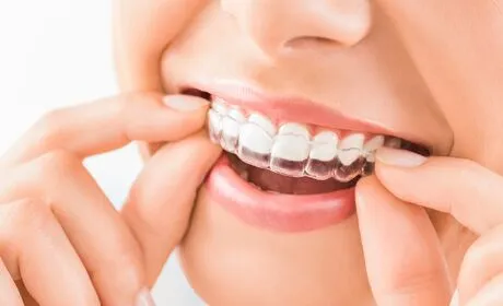 What happens during teeth whitening treatment?