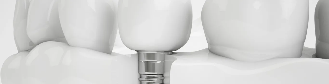Implant Technology
